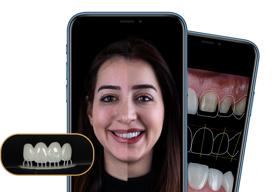 before and after dental treatment with Dr. Clark