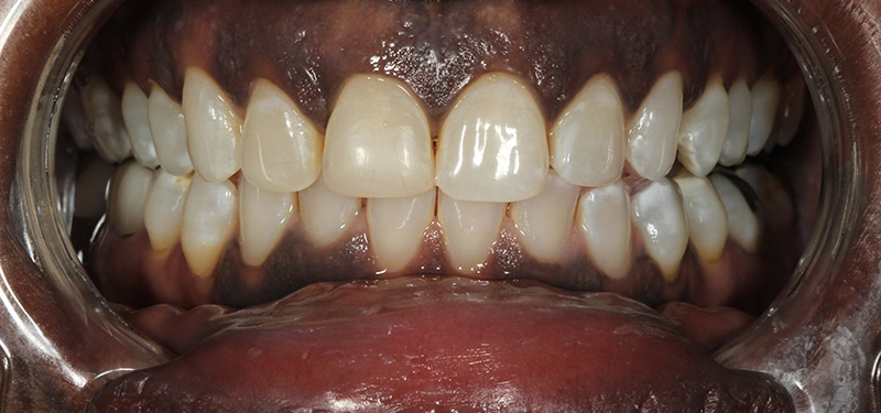 dental treatment with Dr. Clark