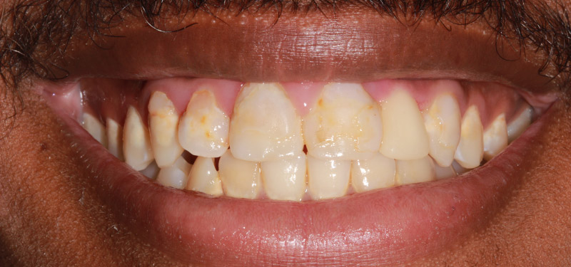 before dental treatment with Dr. Clark
