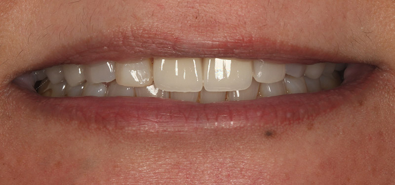 after dental treatment with Dr. Clark