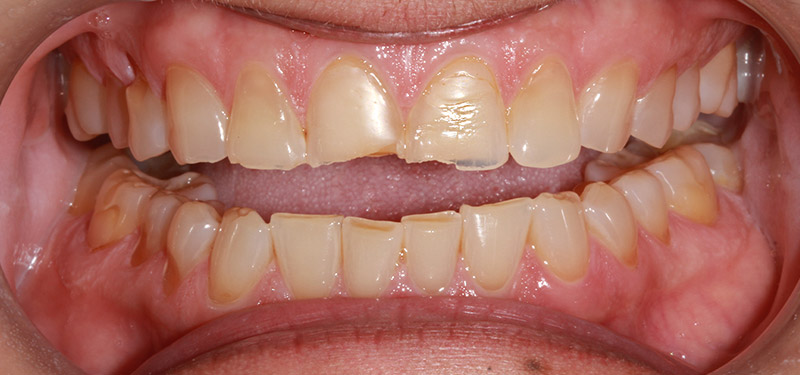 before dental treatment with Dr. Clark