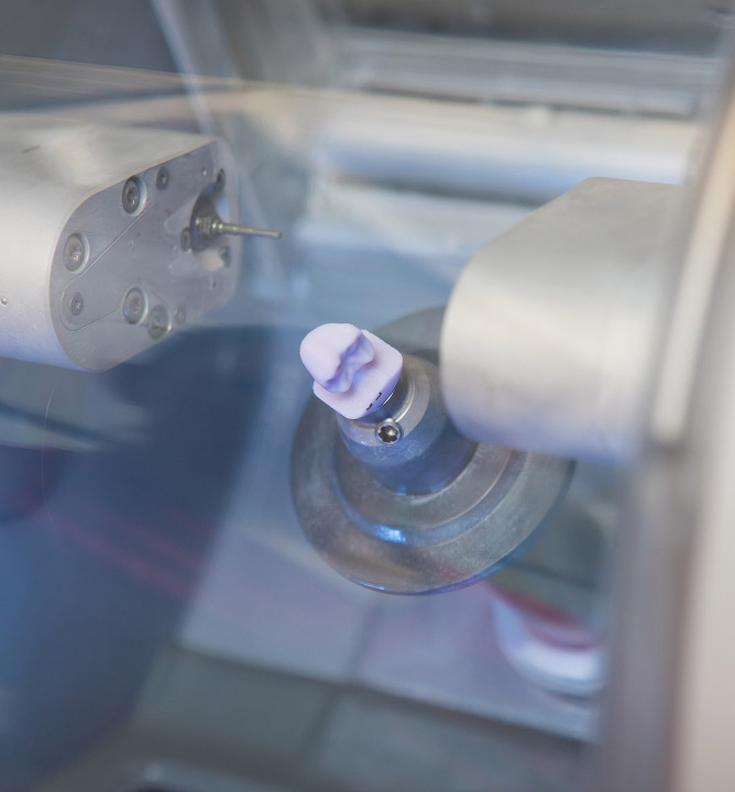 dental technology - cerec same-day dental crowns in Chicago