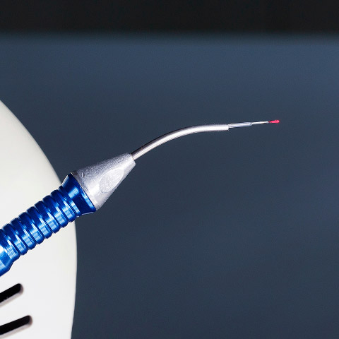 laser dentistry in Chicago