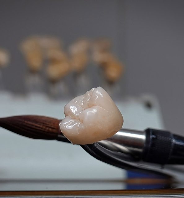 dental crowns near you