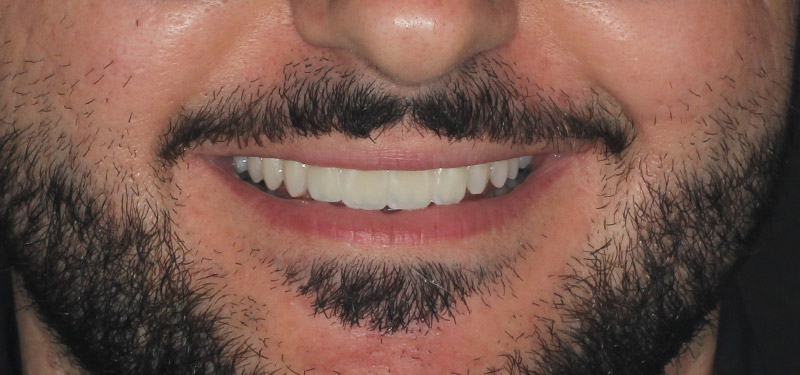 after dental treatment with Dr. Clark