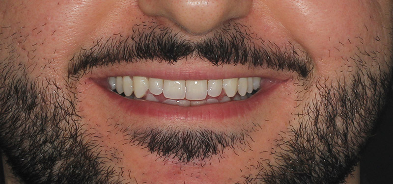 before dental treatment with Dr. Clark